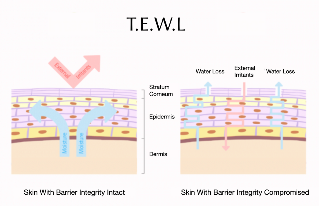 What is T.E.W.L & How to Prevent it