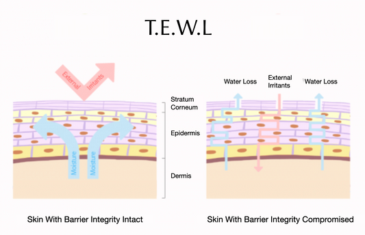 What is T.E.W.L & How to Prevent it