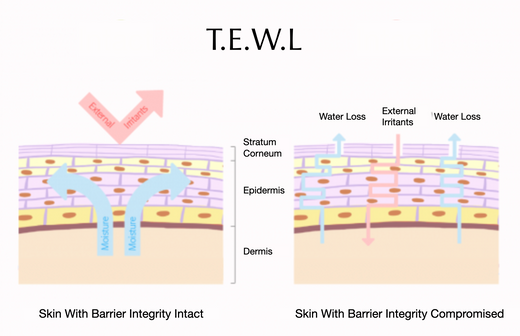 What is T.E.W.L & How to Prevent it